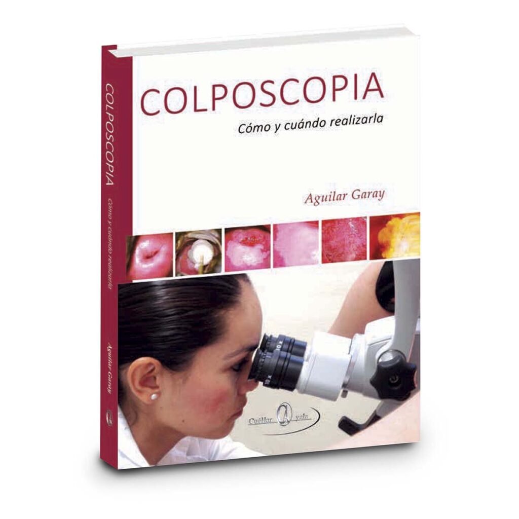Colposcopia como y cuando realizarla