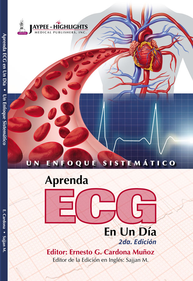Aprende ECG en un día