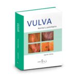 Vulva – Normal y Patológia